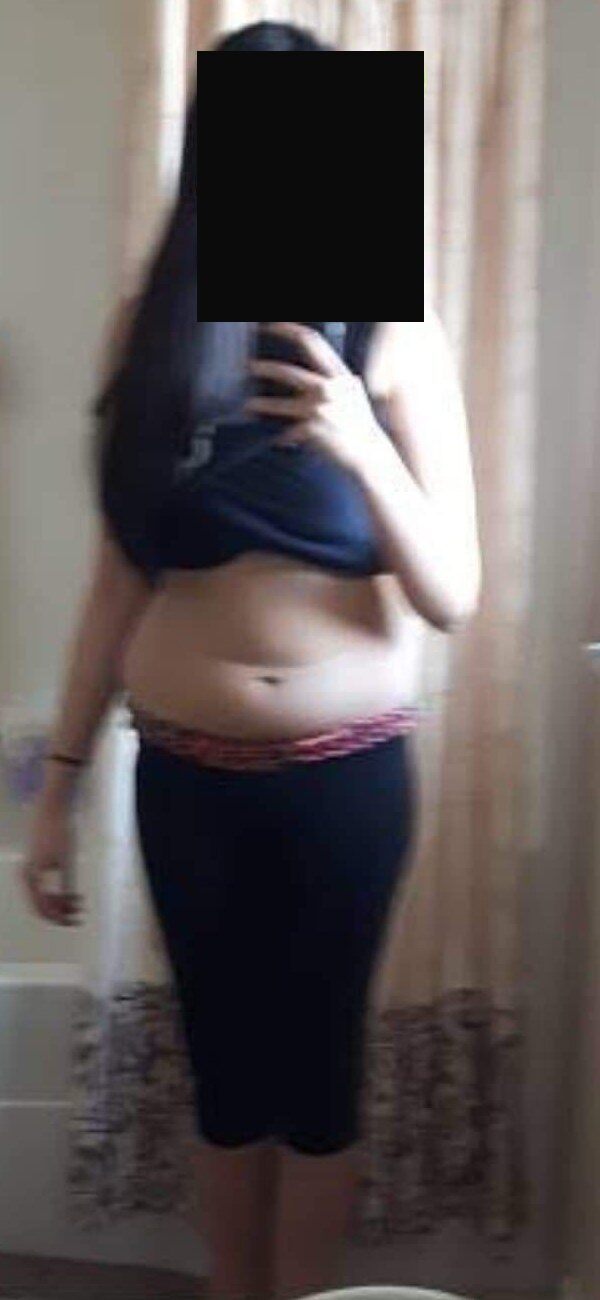 Priya before, photo 2